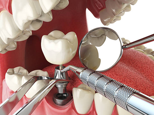 Best Emergency Treatment for Dental Infections or Abscesses in Neah Bay, WA